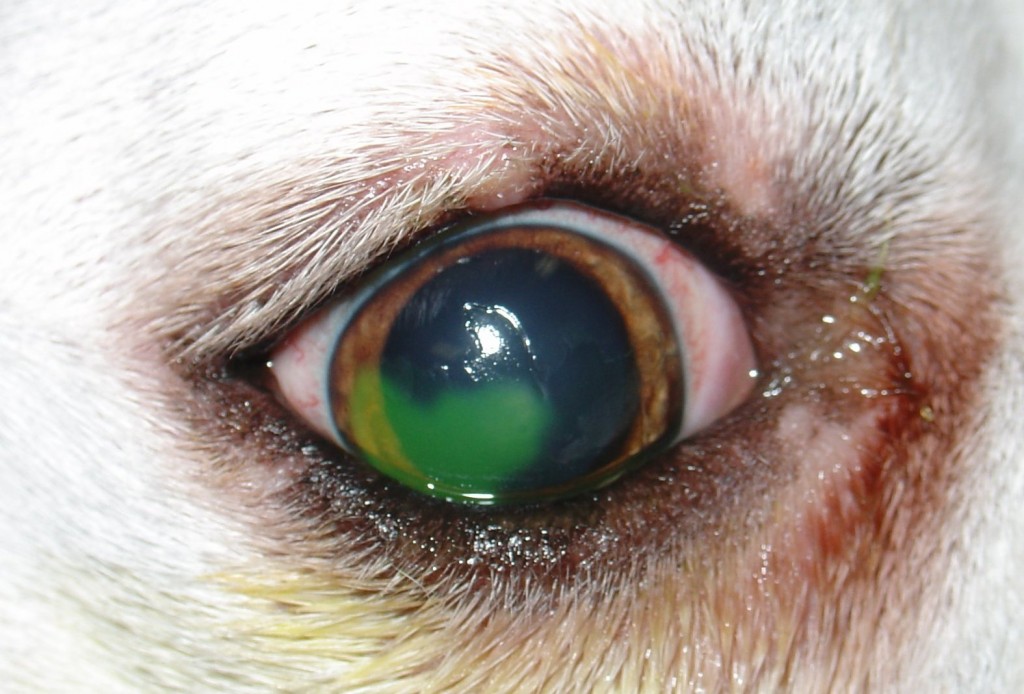 Refractory_corneal_ulcer